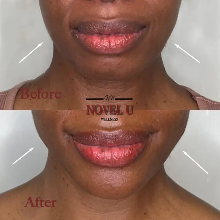 Before & After