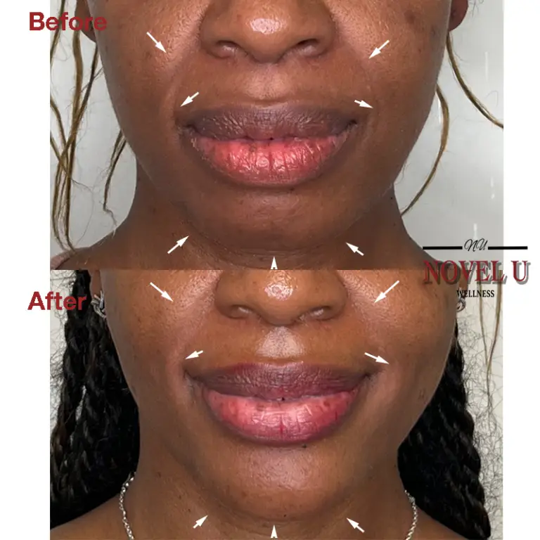 Before & After
