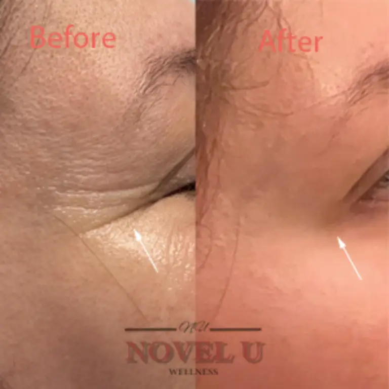 Before & After