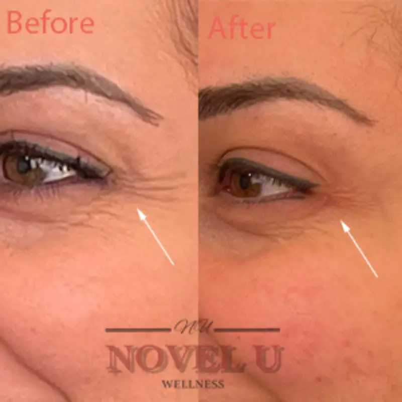Before & After