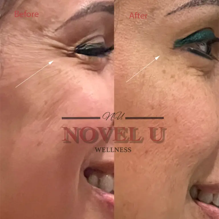 Before & After
