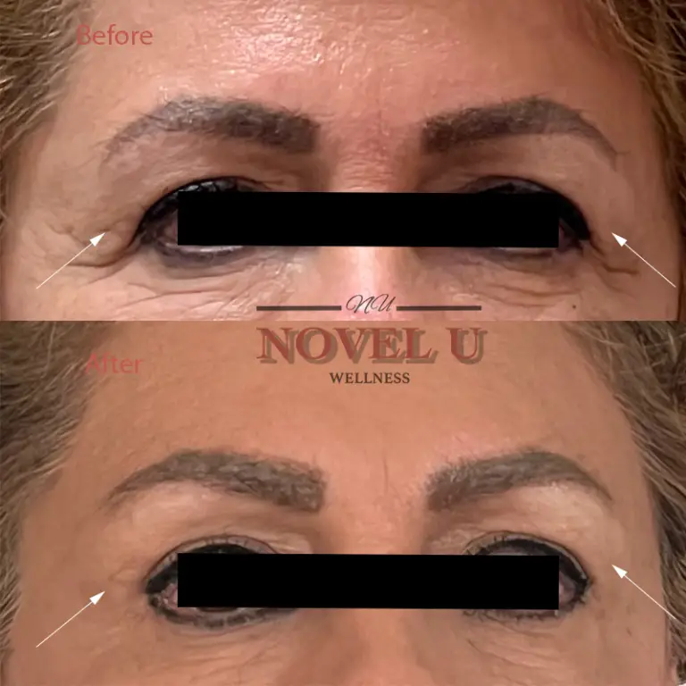 Before & After
