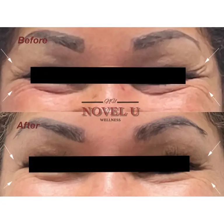 Before & After