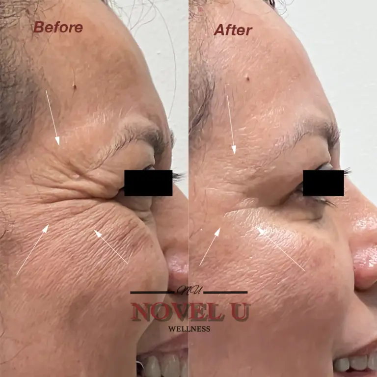 Before & After