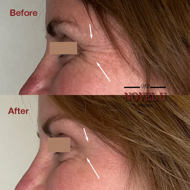 Before & After
