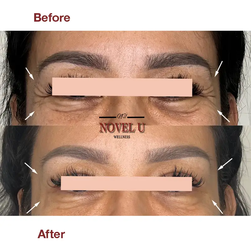 Before & After