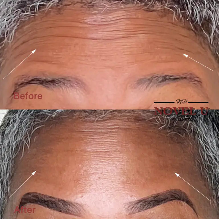 Before & After