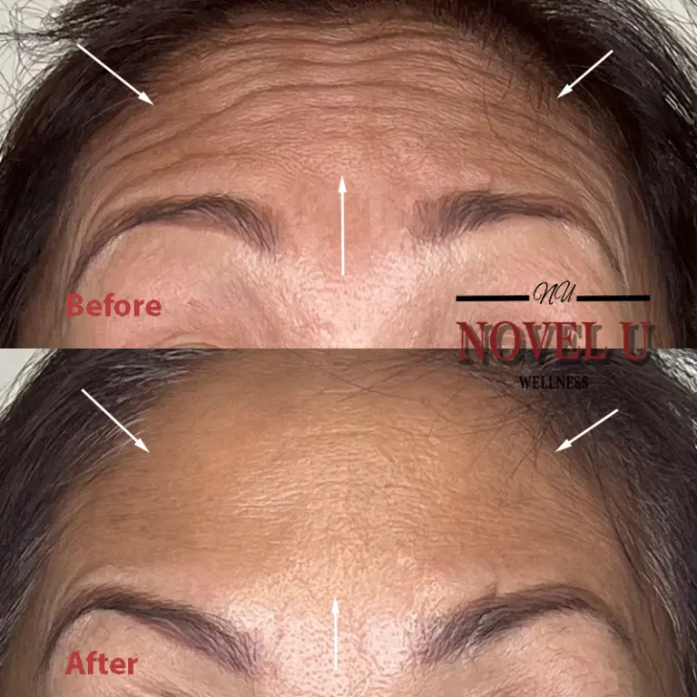 Before & After