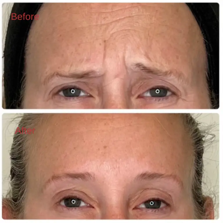 Before & After