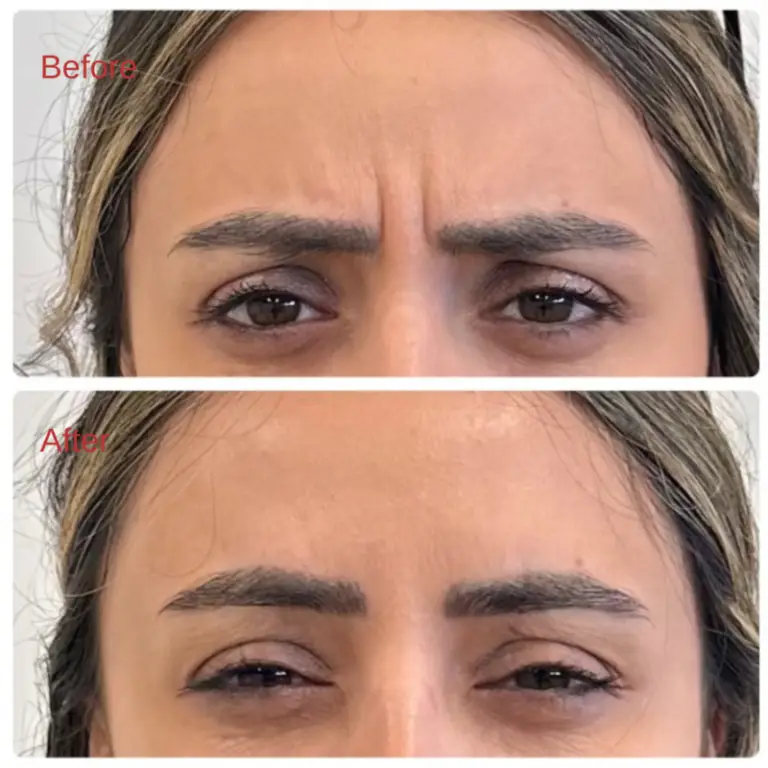 Before & After