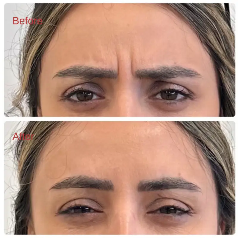 Before & After