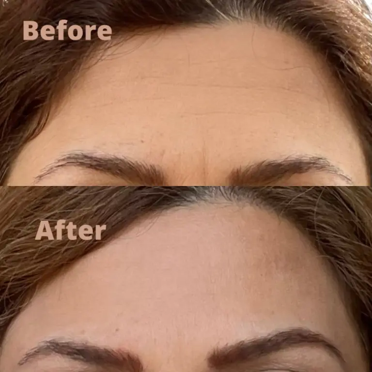 Before & After