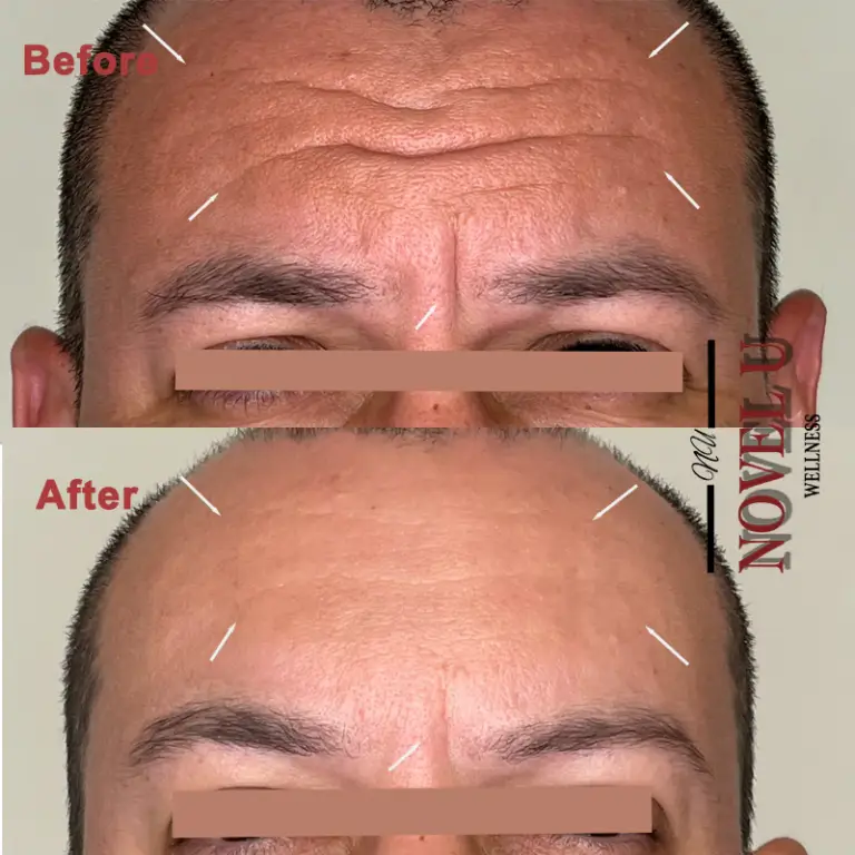 Before & After
