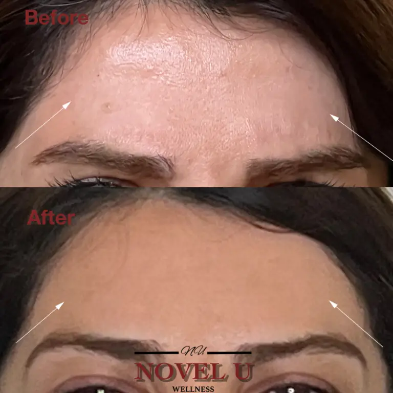 Before & After