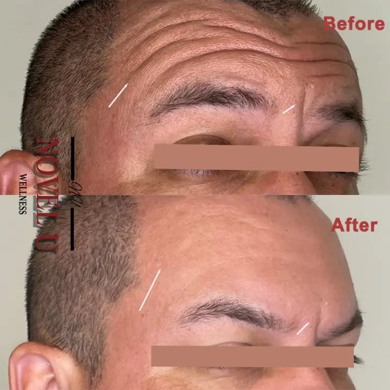 Before & After