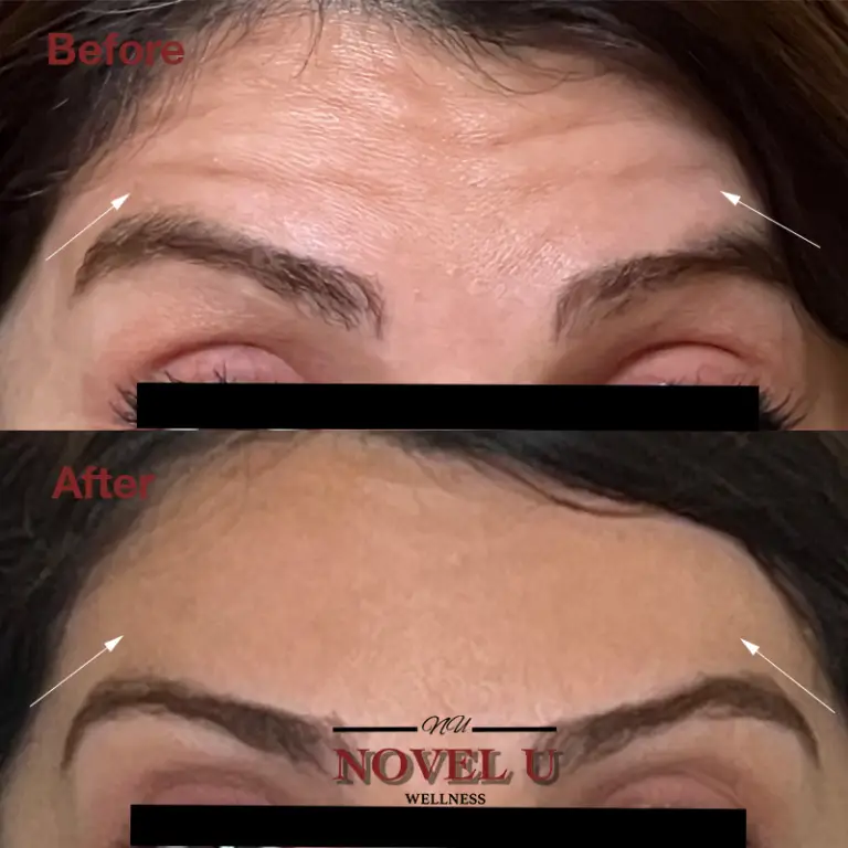 Before & After
