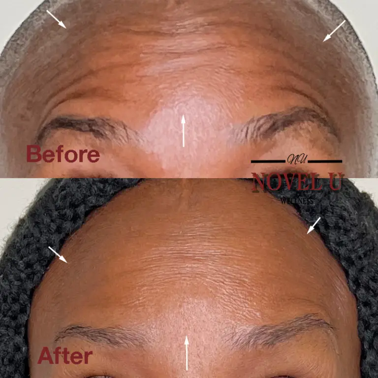 Before & After