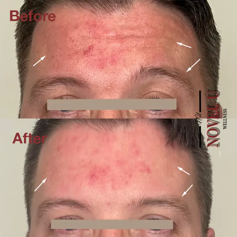 Before & After