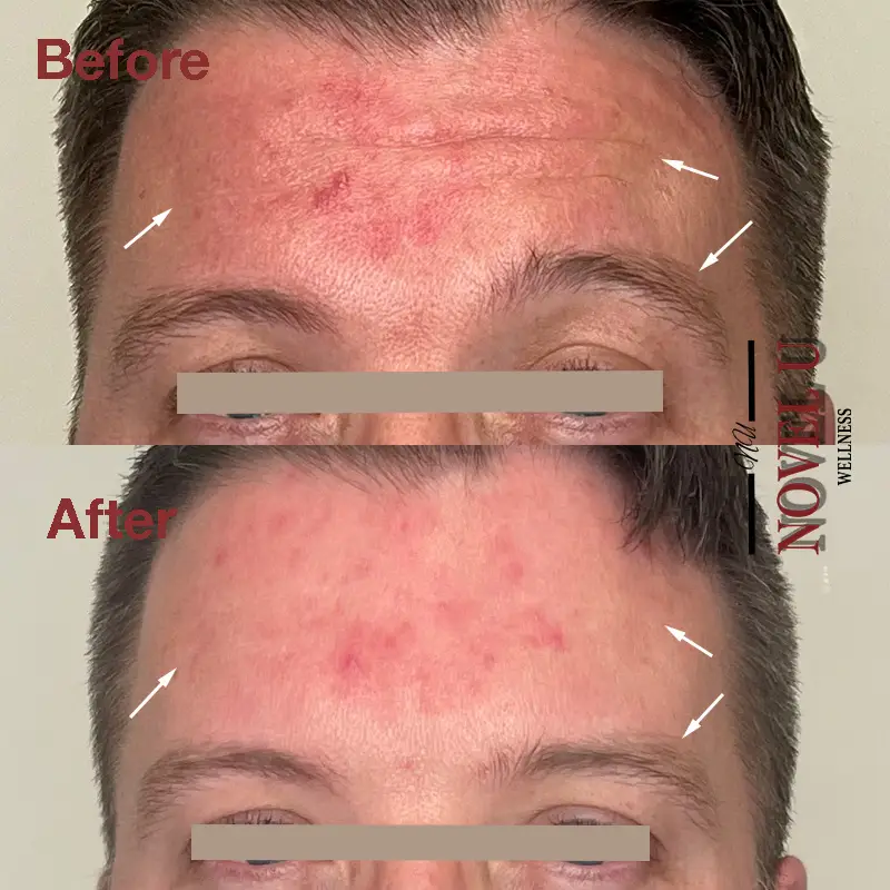 Before & After