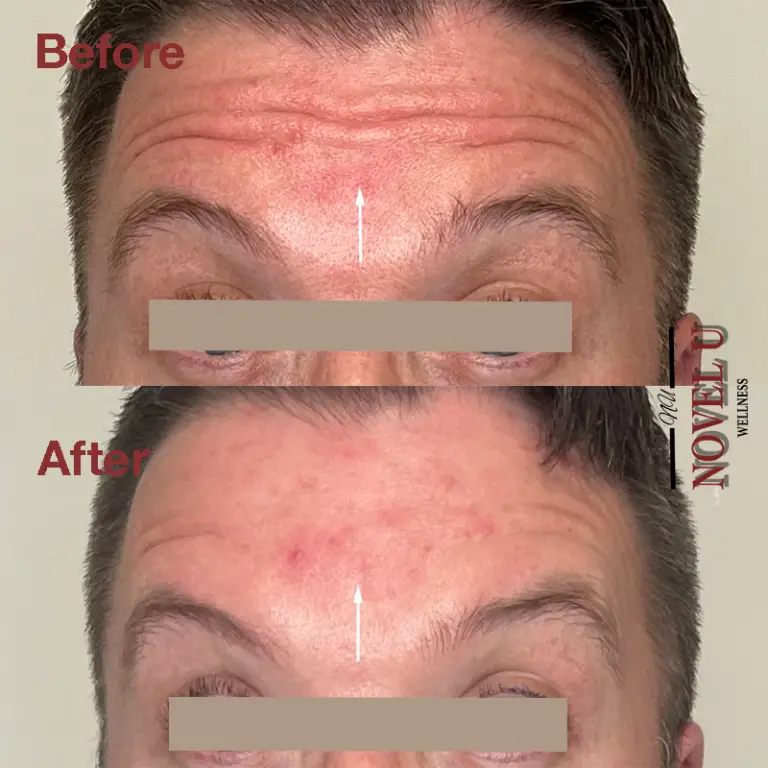 Before & After