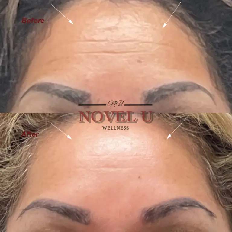 Before & After