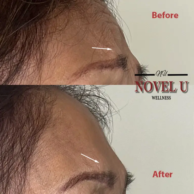 Before & After