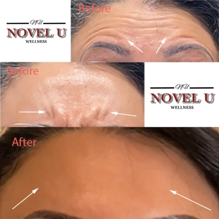 Before & After