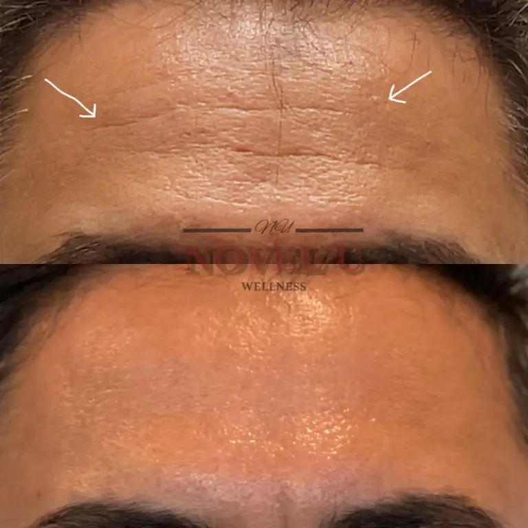 Before & After