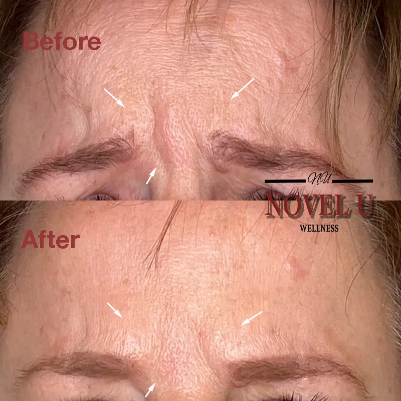 Before & After