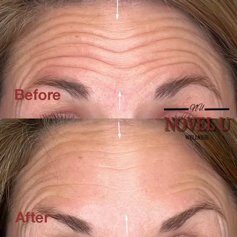 Before & After