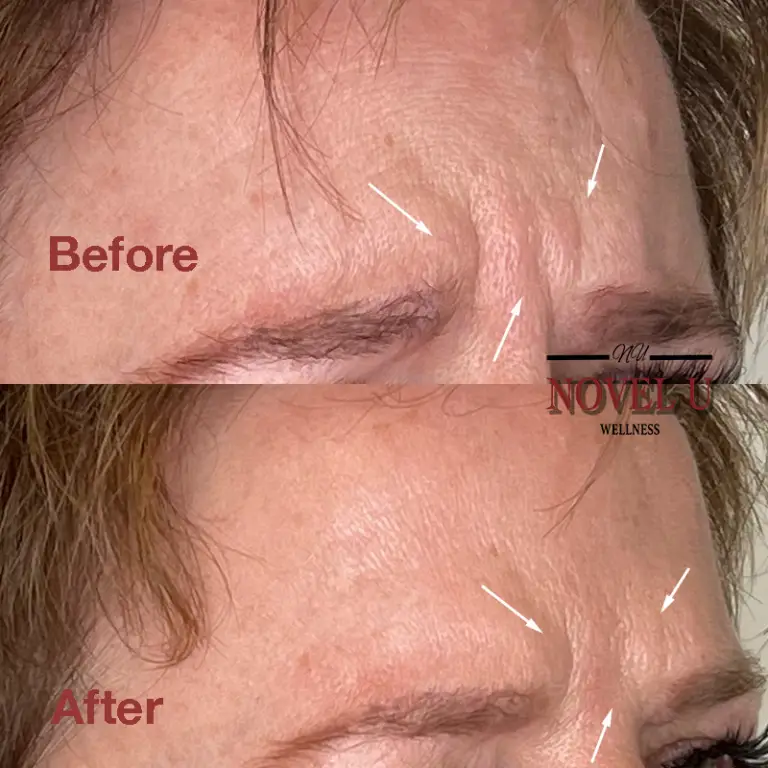 Before & After