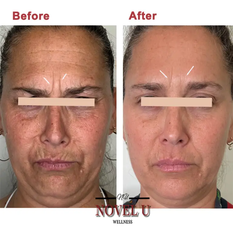 Before & After