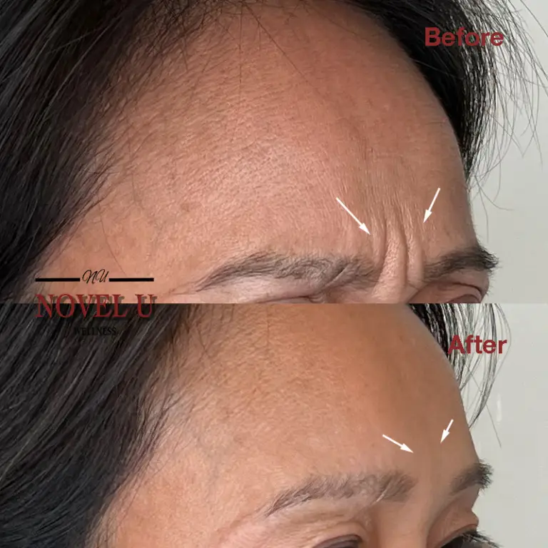 Before & After