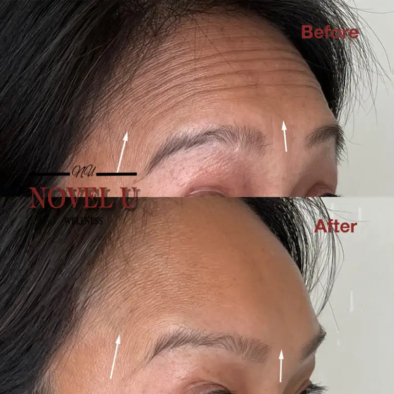 Before & After