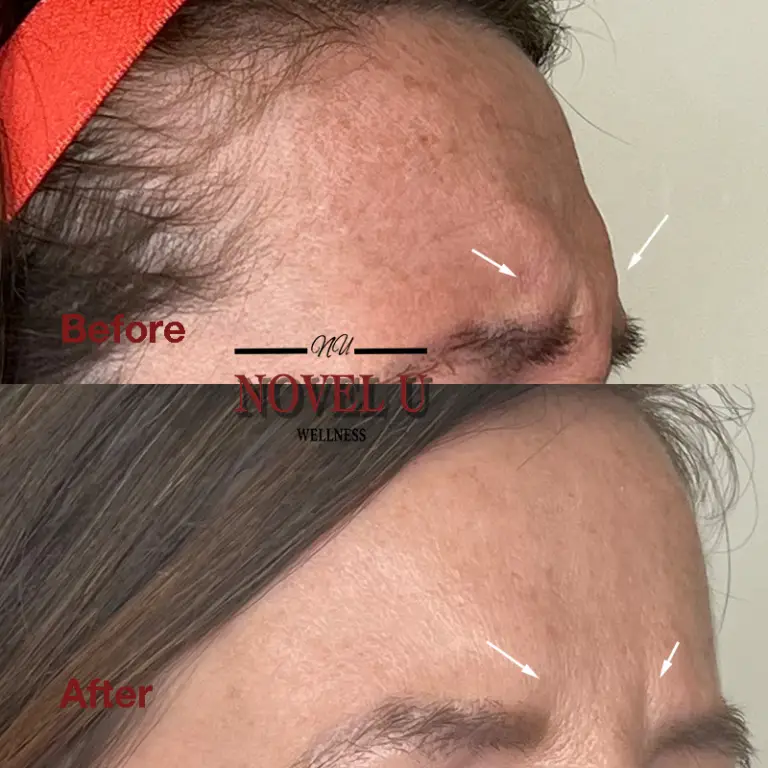 Before & After