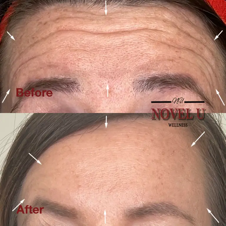 Before & After