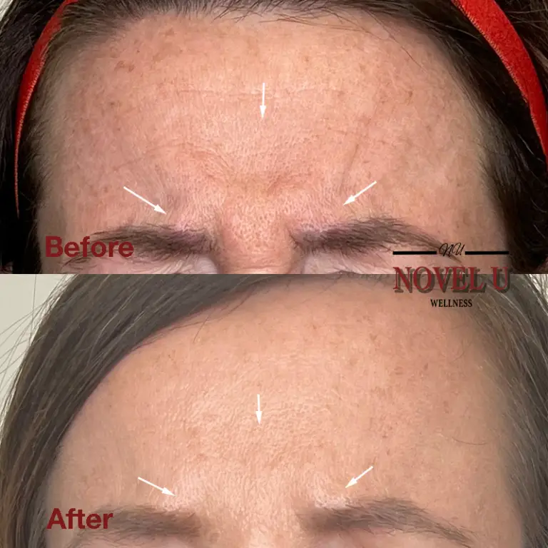 Before & After