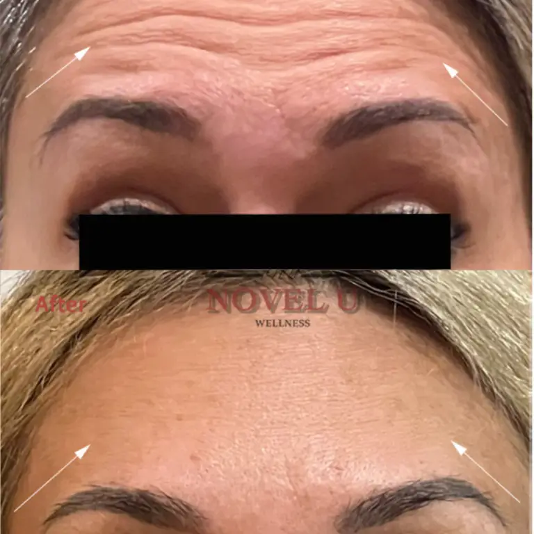 Before & After