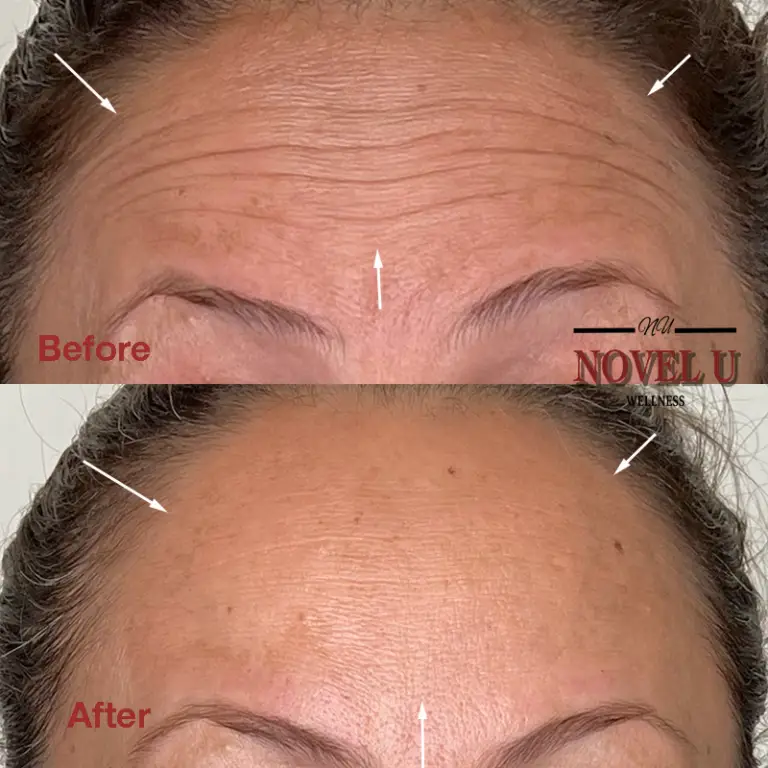 Before & After