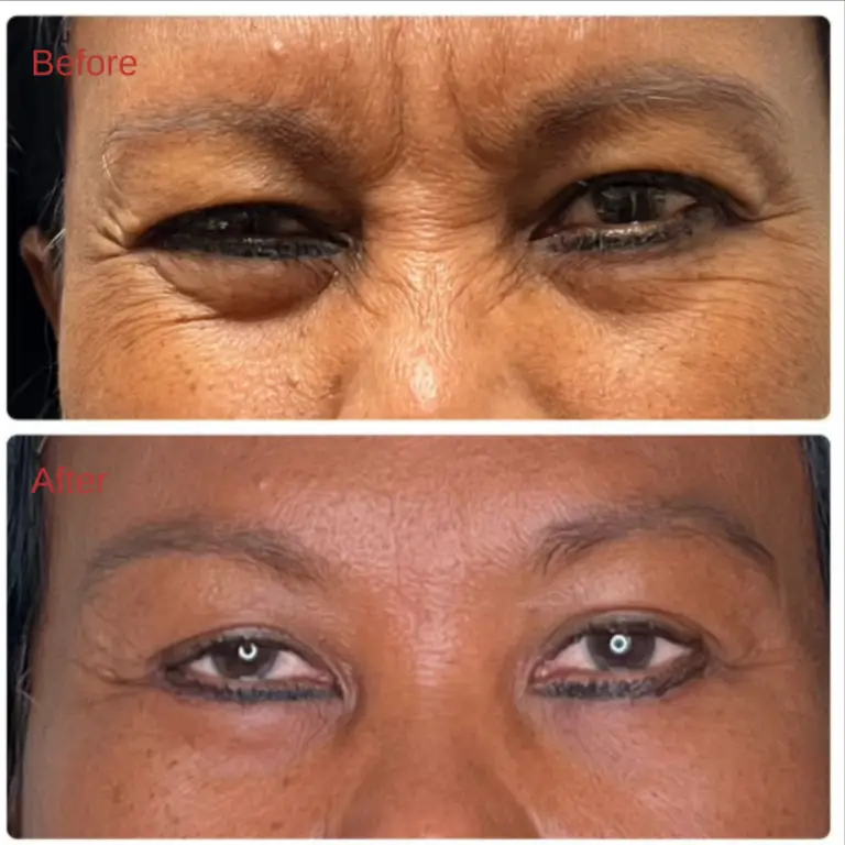 Before & After