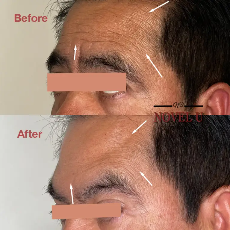 Before & After