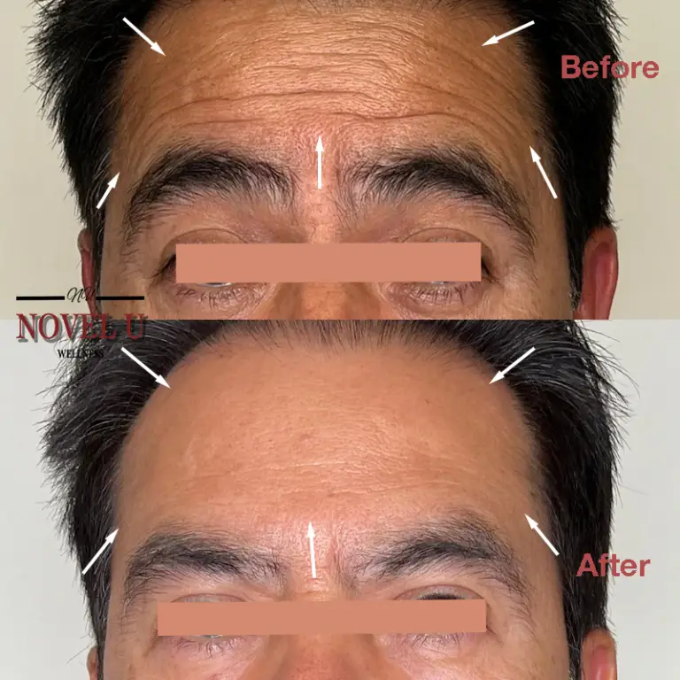 Before & After