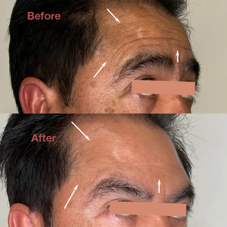 Before & After