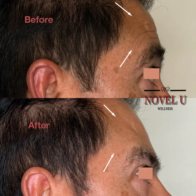 Before & After