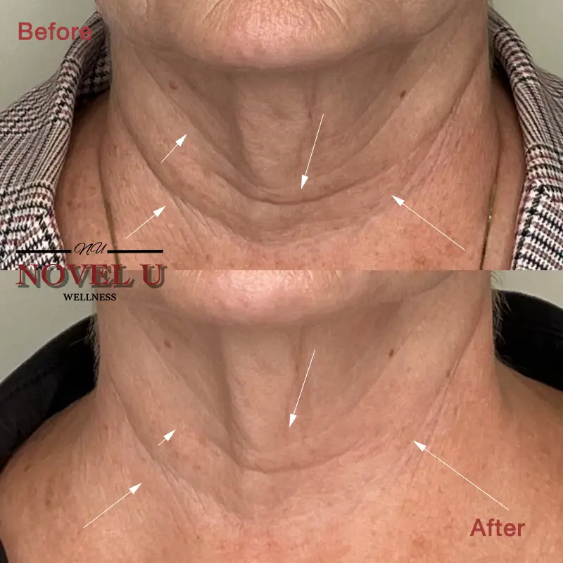 Before & After