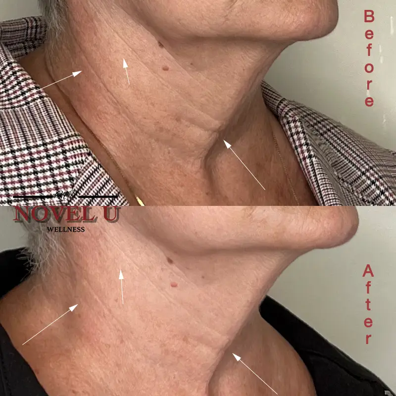 Before & After