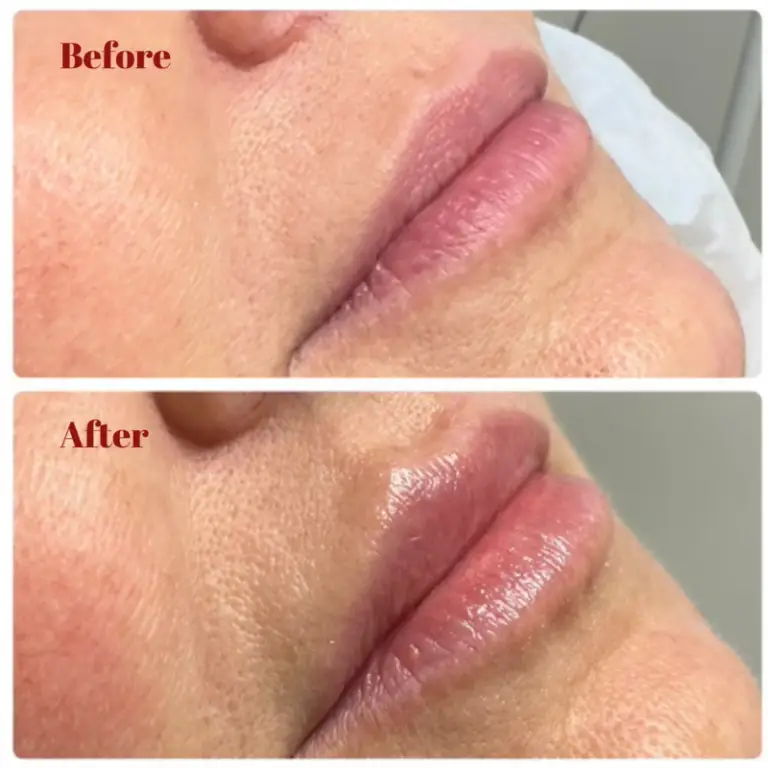 Before & After