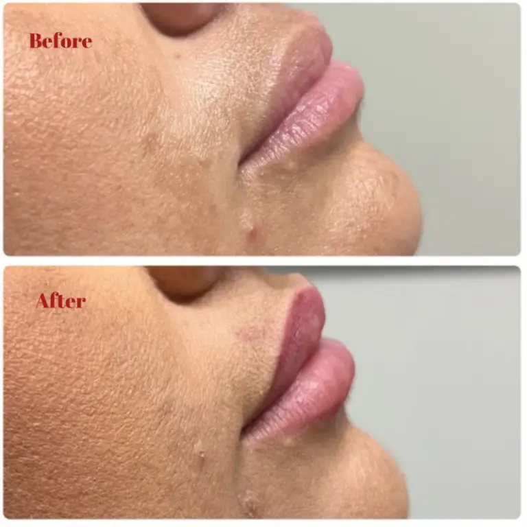 Before & After