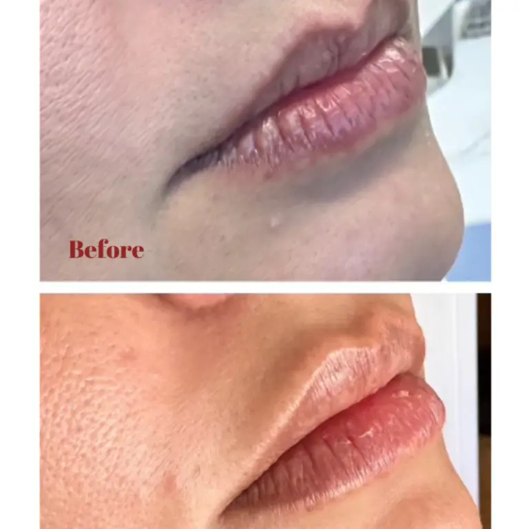 Before & After