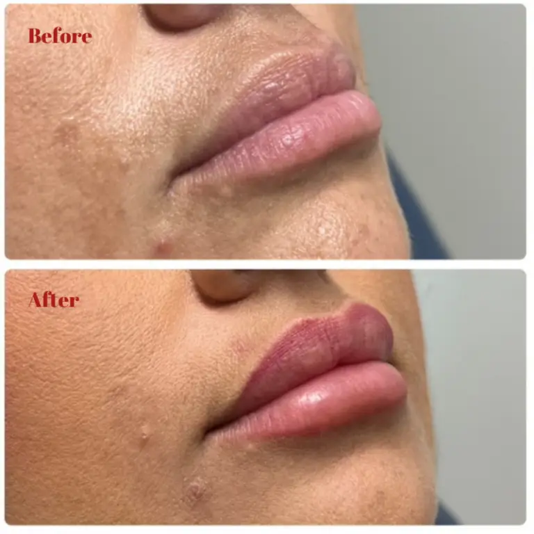 Before & After